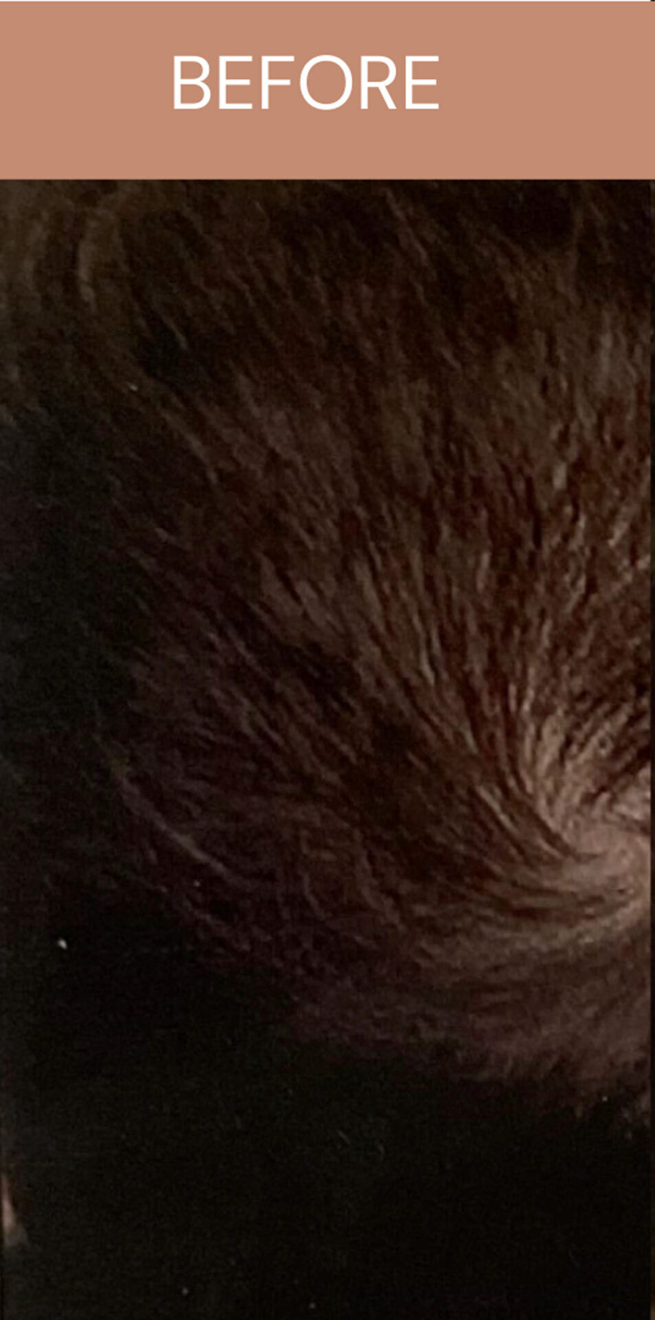 condition of a man's hair before hair regrowth treatment